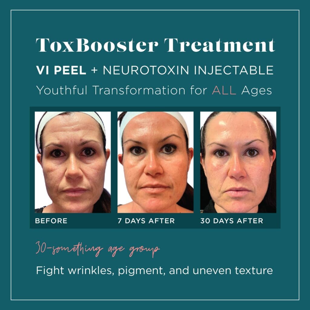 A picture of the results of an injectable treatment.