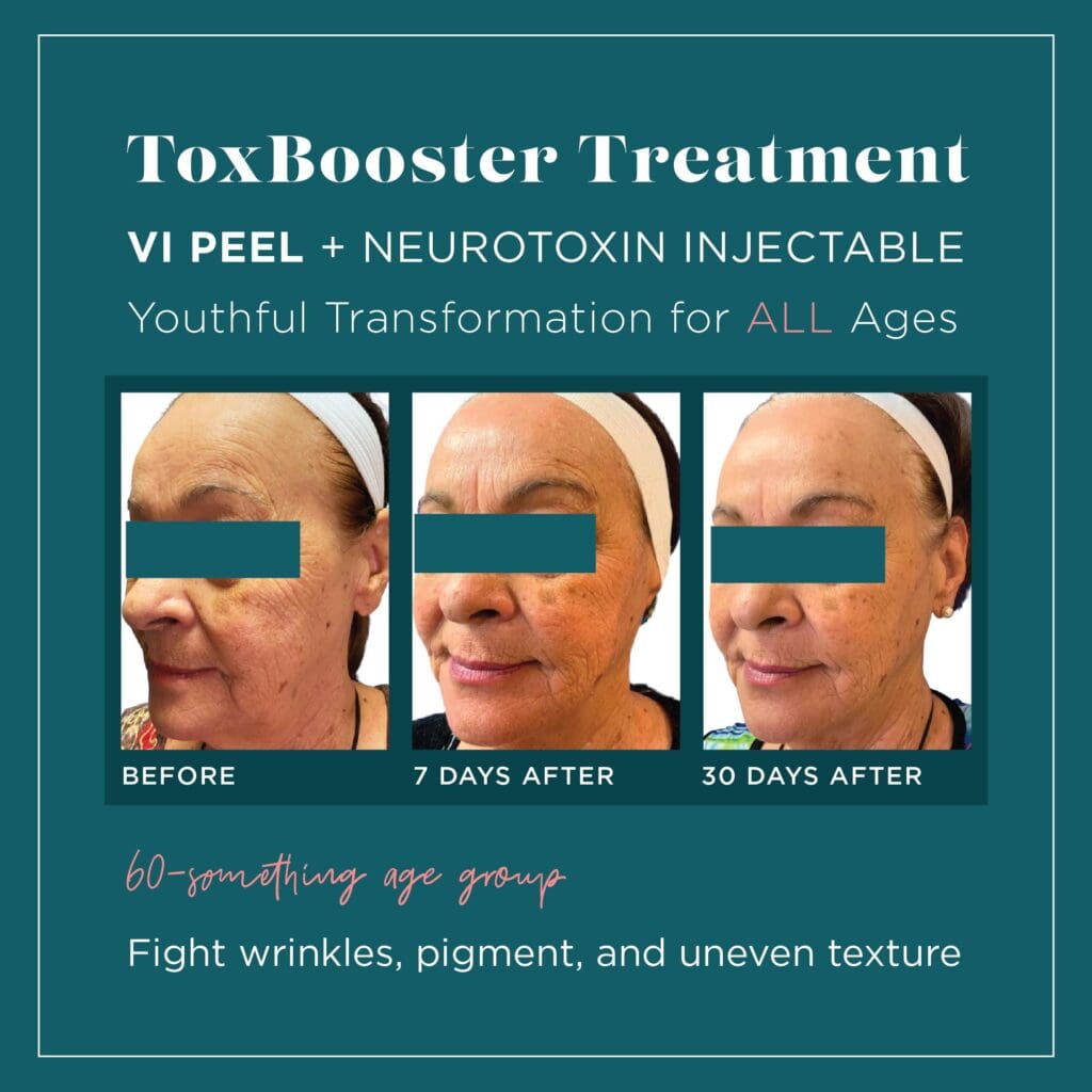 A picture of the results for an injectable treatment.
