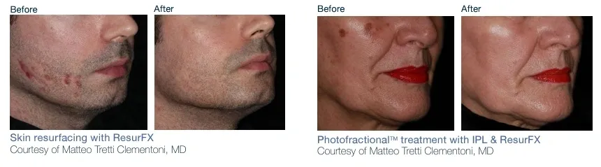 A man 's face before and after the procedure.